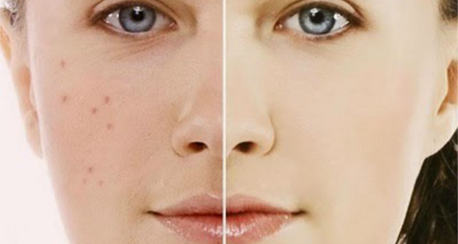 Image Variety